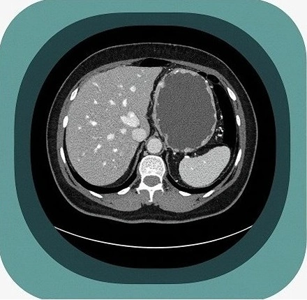 CT abdomen  anatomy icon